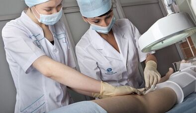 Tratamentul chirurgical al varicelor