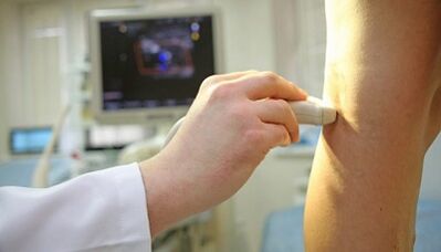 Tratamentul cu laser al varicelor