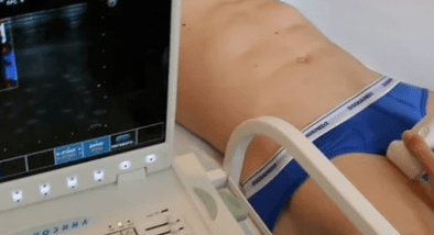 Opțiuni de diagnostic pentru varice vene ale extremităților inferioare